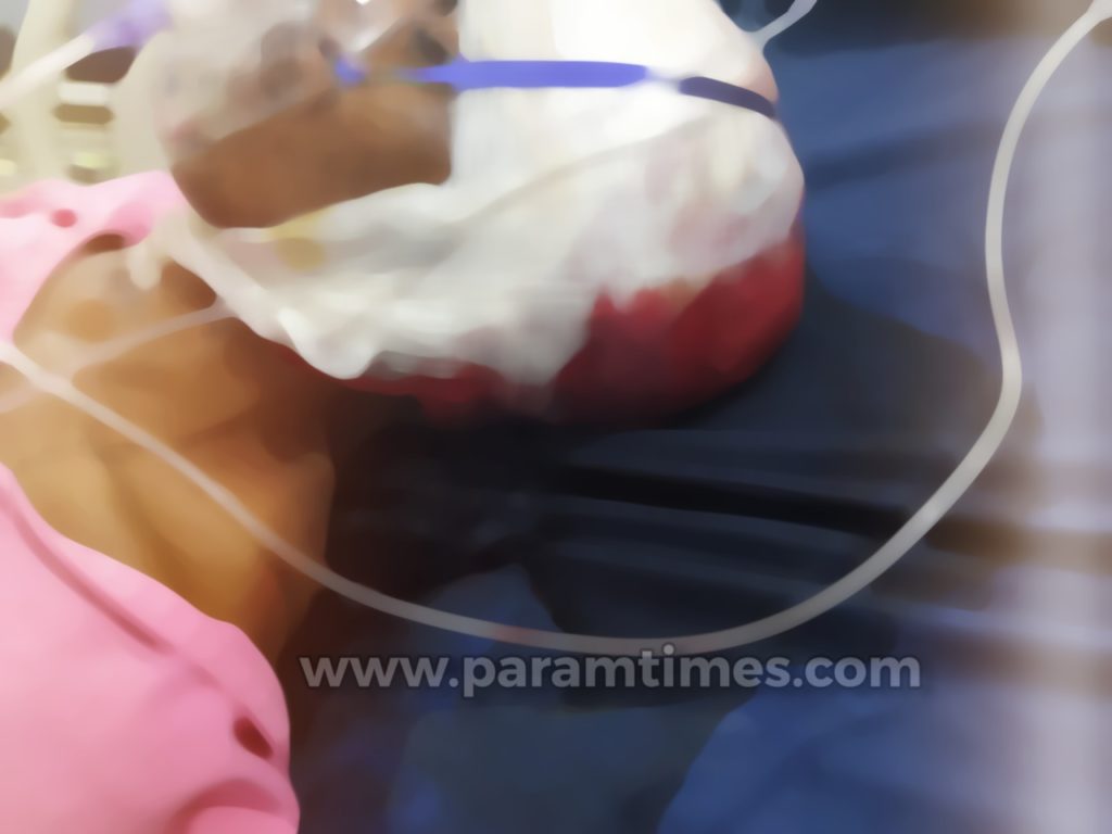 मोहम्मदपुर थाना क्षेत्र के डुमरिया घाट चौक पर दुकान चला रहे व्यक्ति पर हमला